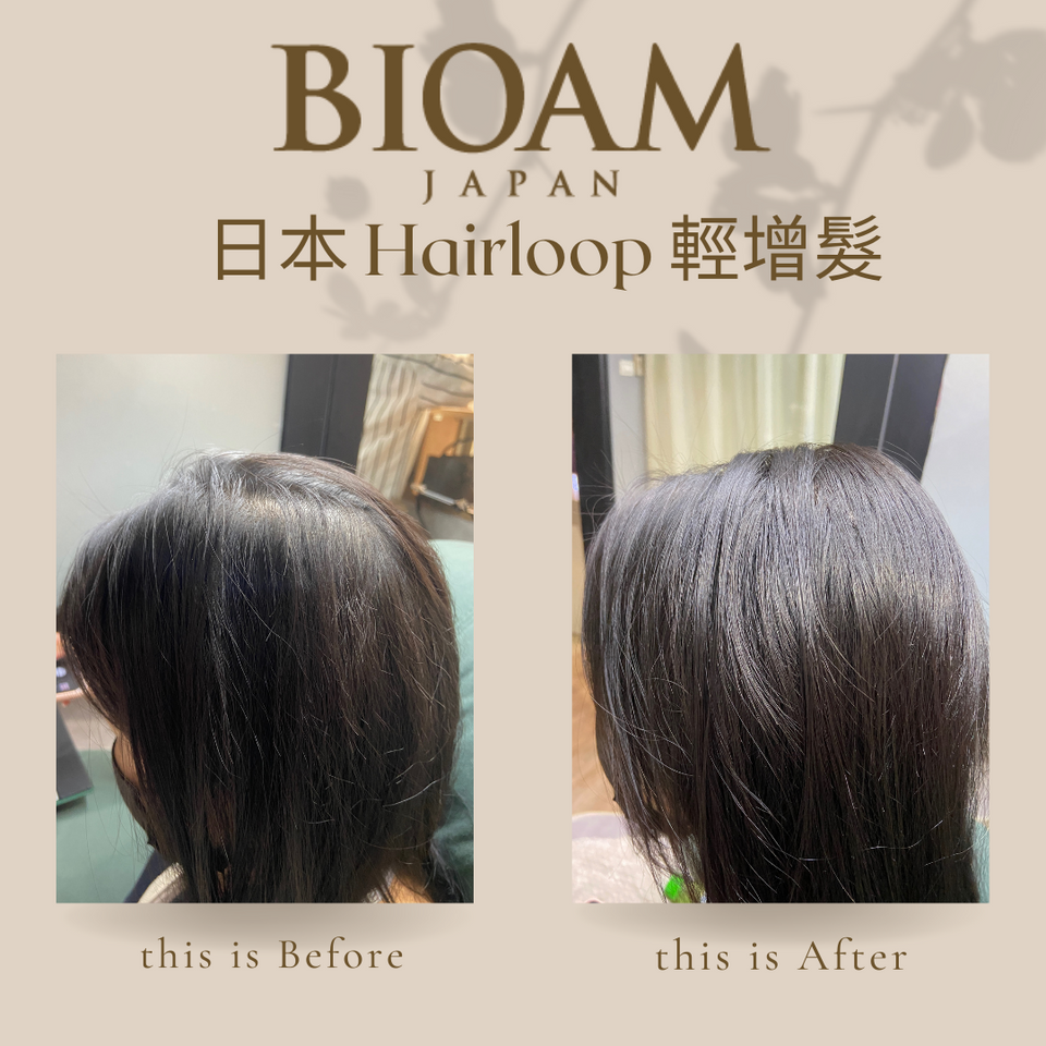 Bioam Exloop【初次限定】 輕增髮術隨心所欲的活動中！ - FDMHAIR